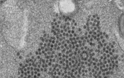 Misteriosa enfermedad paralizante alcanza cifras récord en EE.UU.