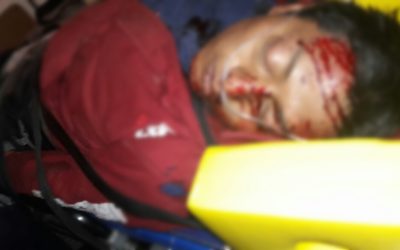 Amputan pierna a motorista arrollado en Salcajá