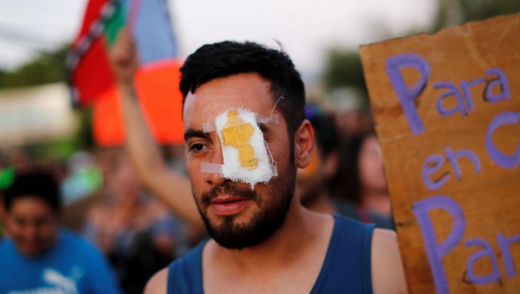 La represión en Chile deja cientos de manifestantes con heridas oculares