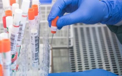 Pruebas rápidas permitirán definir acciones contra el COVID-19