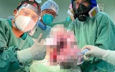 ¿Cuánto pesa el bebé más grande que ha nacido en el HRO?