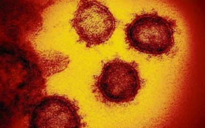 Según informe presentado por el Laboratorio Nacional de Salud (LNS), variante Delta predomina en Guatemala