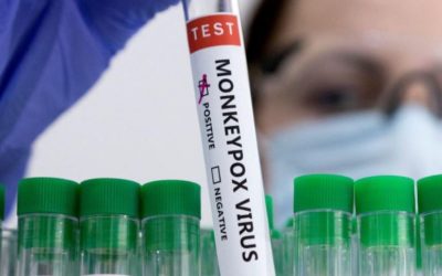 ¿Qué recomiendan los expertos ante primer caso confirmado de viruela del mono en Venezuela?