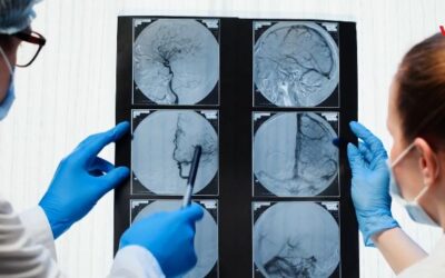 La obesidad podría ser factor clave en incremento de cáncer en jóvenes: científicos