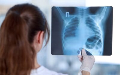 Hoy en la historia | El 8 de noviembre se celebra el «Día mundial de la radiografía».