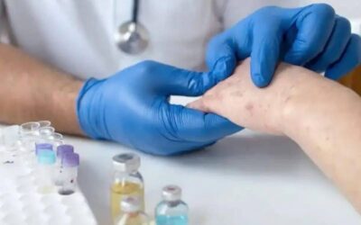 Reportan 117 casos de sarampión en Xela; refuerzan medidas en centros de salud